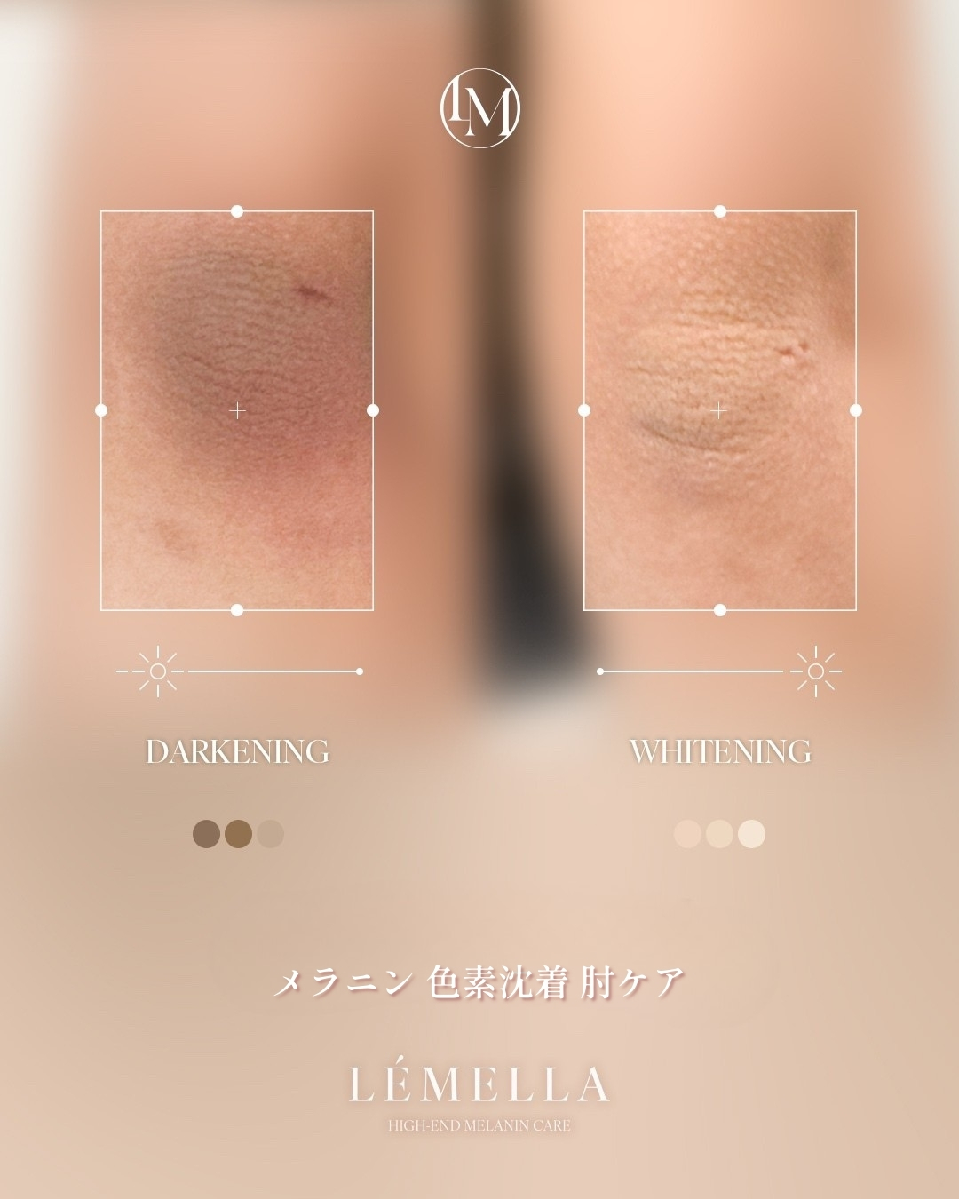 肌のターンオーバーを整える